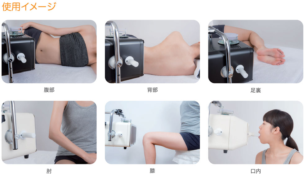 光線治療器SANAMORE施術画像